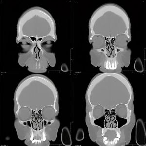 Image Guided Surgery 